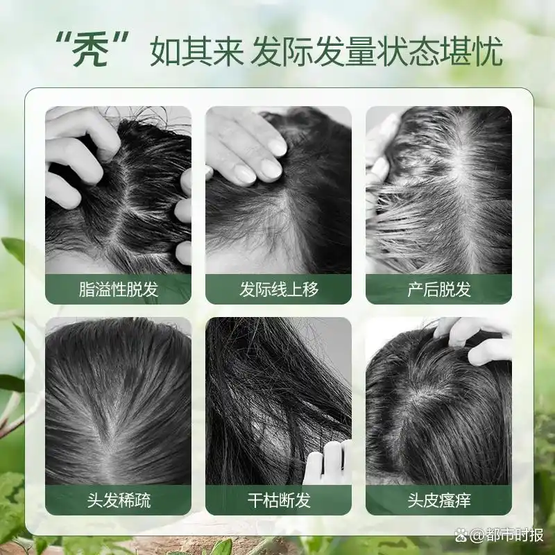 2025口碑好的洗发水品牌！防脱育发洗发水哪个牌子最有效？防脱洗发水真实测评！