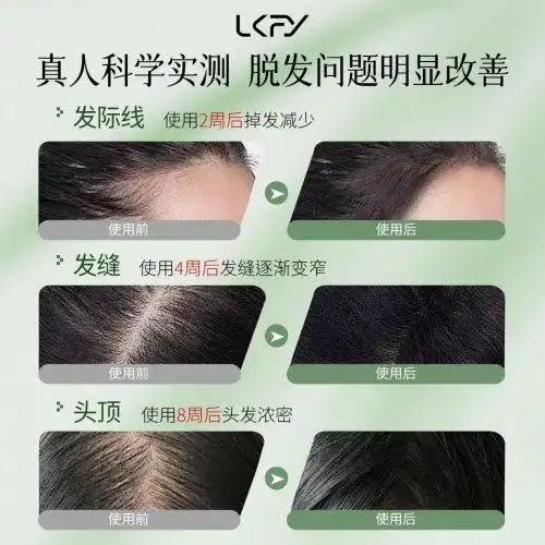 防脱生发洗发水排名前十名！哪个牌子的国产洗发水防脱效果好？