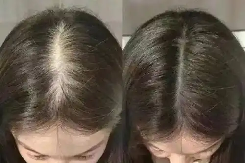 防脱生发洗发水排名前十名！哪个牌子的国产洗发水防脱效果好？